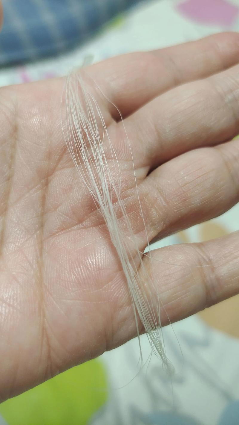 银合金在医疗行业的应用与展望